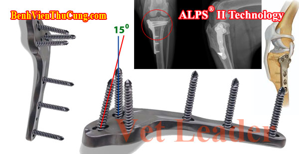 Thiết bị y tế phẫu thuật thú y : Nẹp xương TPLO đa trục ALPS II thú y - Veterinary orthopedic Tibial Plateau Leveling Osteotomy with poly-axial Advanced Locking Plate System gen 2 Vet Leader NTPA
